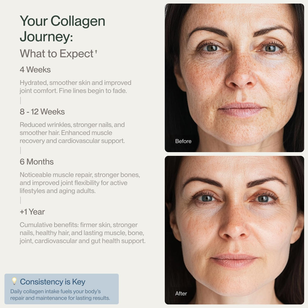 Collagen Peptides Powder Grass-Fed Pasture-Raised Hydrolyzed Type I & III Unflavored 32 oz A6345